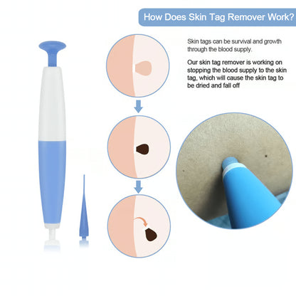 Painless Skin Tag Removal Kit for Safe At Home Skin Care Treatment